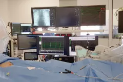 Rythmologie écrans de contrôle