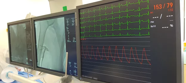 Angioplastie coronaire écrans de contrôle